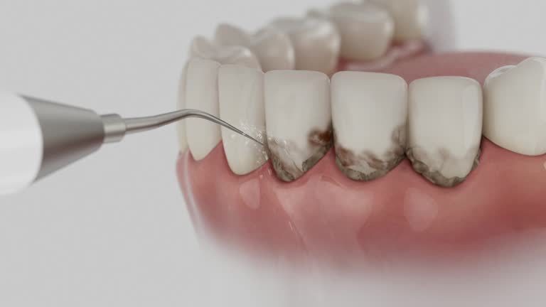 Trusted Teeth Cleaning And Checkup service in Pine Grove, CA - Dentist Open Now